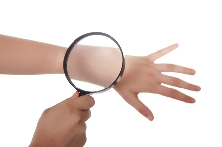 10450129 - hand, magnifying glass and skin
